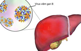 Thế nào là phơi nhiễm viêm gan B? | Vinmec