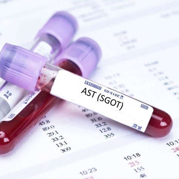 AST là gì? Cách giảm chỉ số AST cao để bảo vệ gan