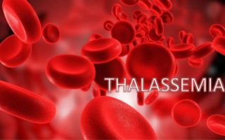 Bệnh thalassemia: Nguyên nhân, triệu chứng và cách điều trị hiệu quả