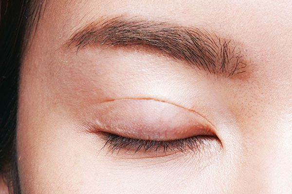 Bị ngứa mắt: Nguyên nhân, triệu chứng và cách điều trị hiệu quả