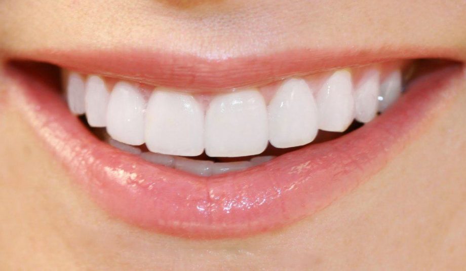 Cách tẩy trắng răng ố vàng hiệu quả và an toàn tại nhà