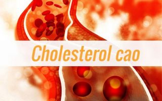 Cholesterol là gì? Nguyên nhân, triệu chứng và cách giảm cholesterol cao
