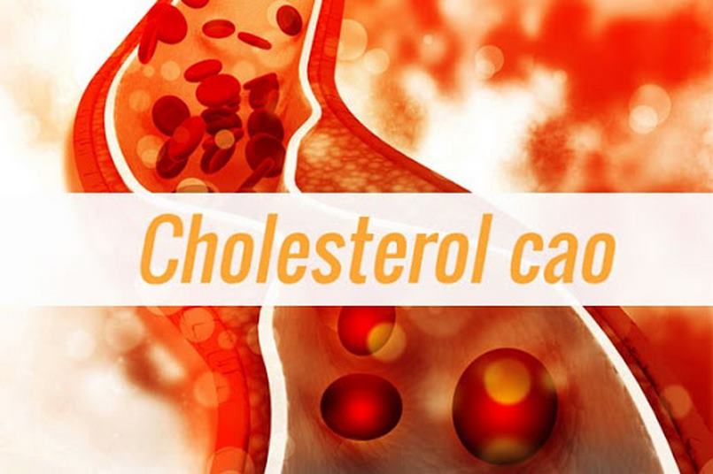 Cholesterol là gì? Nguyên nhân, triệu chứng và cách giảm cholesterol cao