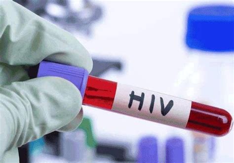 Dấu hiệu nhiễm HIV sau 1 năm: Bạn có biết mình có thể sống khỏe mạnh như người bình thường?