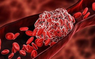 Dấu hiệu thiếu máu: Nguyên nhân, hậu quả và cách phòng ngừa