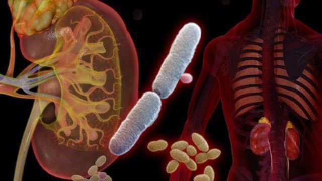 Nhiễm khuẩn tiết niệu: Nguyên nhân, triệu chứng, điều trị và cách phòng ngừa
