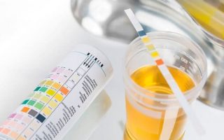 Nước tiểu có mùi hôi: Nguyên nhân, cách phòng ngừa và điều trị