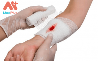 Thuốc cầm máu: Bạn có biết cách sử dụng đúng và an toàn?