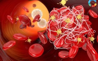 Thuốc chống đông máu: Những điều cần biết để sử dụng an toàn và hiệu quả