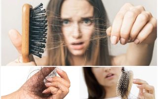 Thuốc chống rụng tóc: Có thật sự hiệu quả? Những điều bạn cần biết trước khi sử dụng