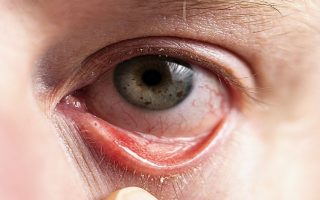 Thuốc nhỏ mắt trị viêm kết mạc: Loại nào tốt nhất và cách sử dụng hiệu quả?