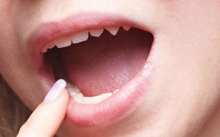 Thuốc trị nhiệt miệng: Những điều bạn cần biết để chọn loại phù hợp và an toàn