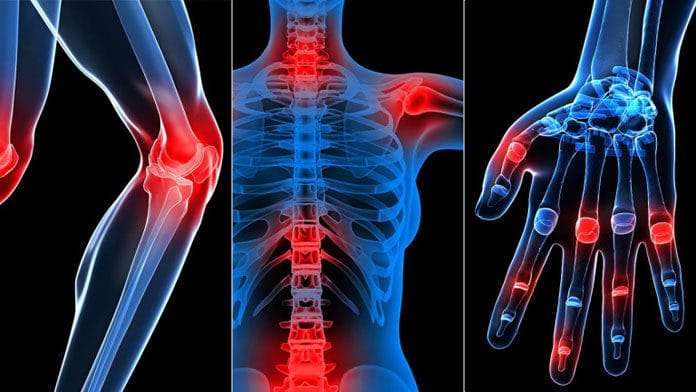 Thuốc xương khớp của Nhật: Bí quyết giúp bạn thoát khỏi đau nhức và tăng cường sức khỏe
